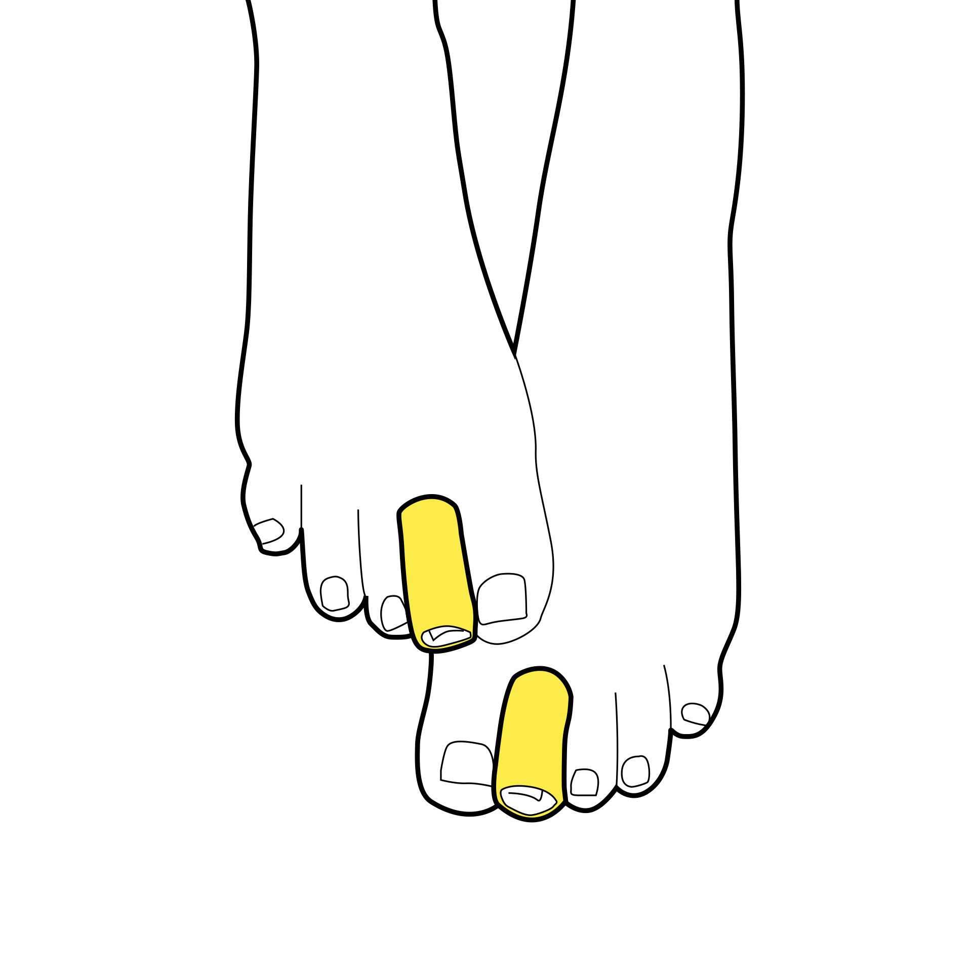 Protezione In Gel Per Dita - Set Da 2 Pz, , large